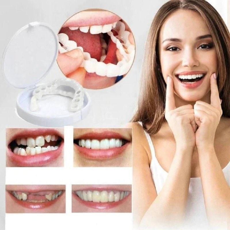 Instant Veneer Transformation Kit for Natural Smile Coverage