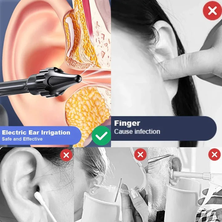 Rechargeable Ear Cleaning Support Irrigation Kit with 3 Pressure Modes and Tips