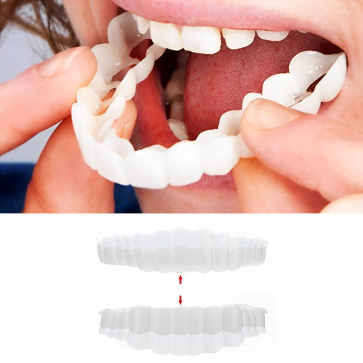 Clip On Teeth Veneer Set for Upper and Lower Coverage