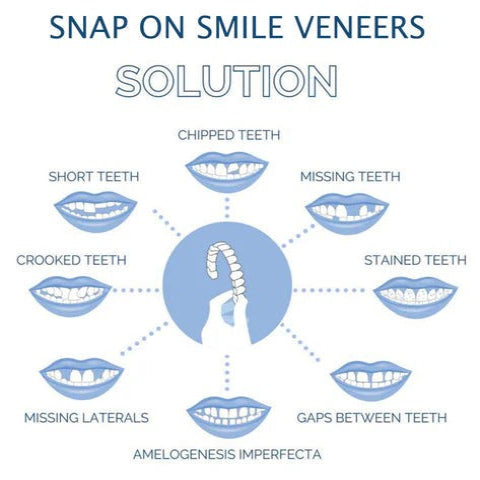 Clip On Teeth Veneer Set for Upper and Lower Coverage
