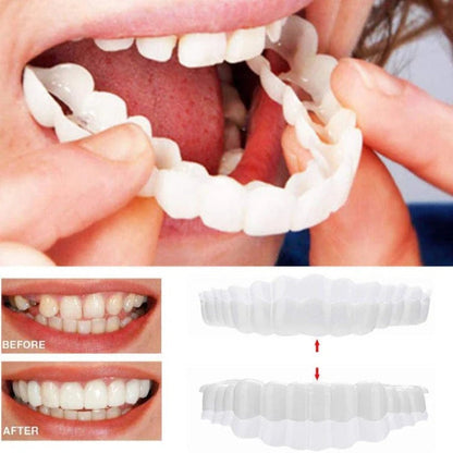 Clip On Teeth Veneer Set for Upper and Lower Coverage