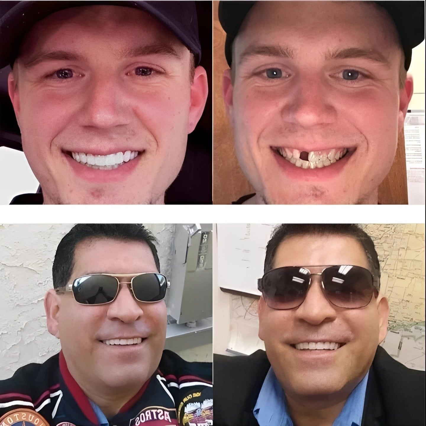 Removable Snap On Smile Cover with Adjustable Fit