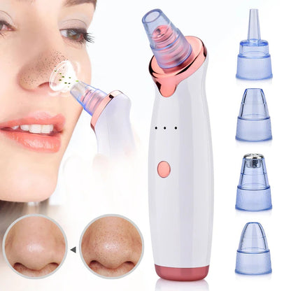 Electric Pore Vacuum with Suction Tip and Charging Cable for Blackhead Removal