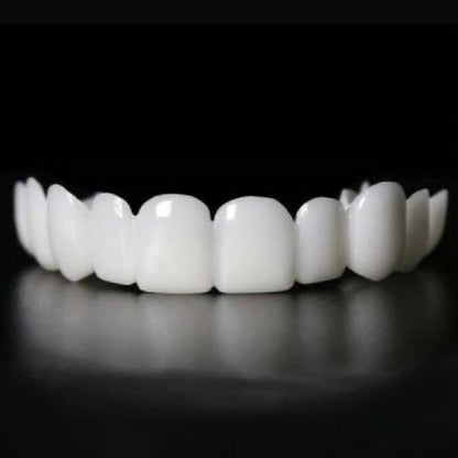 Instant Veneer Transformation Kit for Natural Smile Coverage