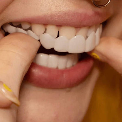 Instant Veneer Transformation Kit for Natural Smile Coverage