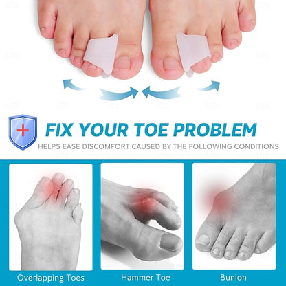 6 Pack Toe Spacers and Separators for Bunion, Curled and Overlapping Toe Alignment for Men and Women