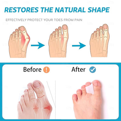 6 Pack Toe Spacers and Separators for Bunion, Curled and Overlapping Toe Alignment for Men and Women
